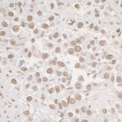 Histone H2AX, p Ser139 Antibody, Novus Biologicals 0.1mL; Unlabeled:Antibodies,
